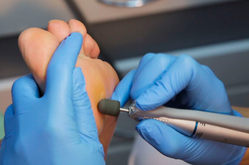 Quiropedia y sus Beneficios para tus Pies