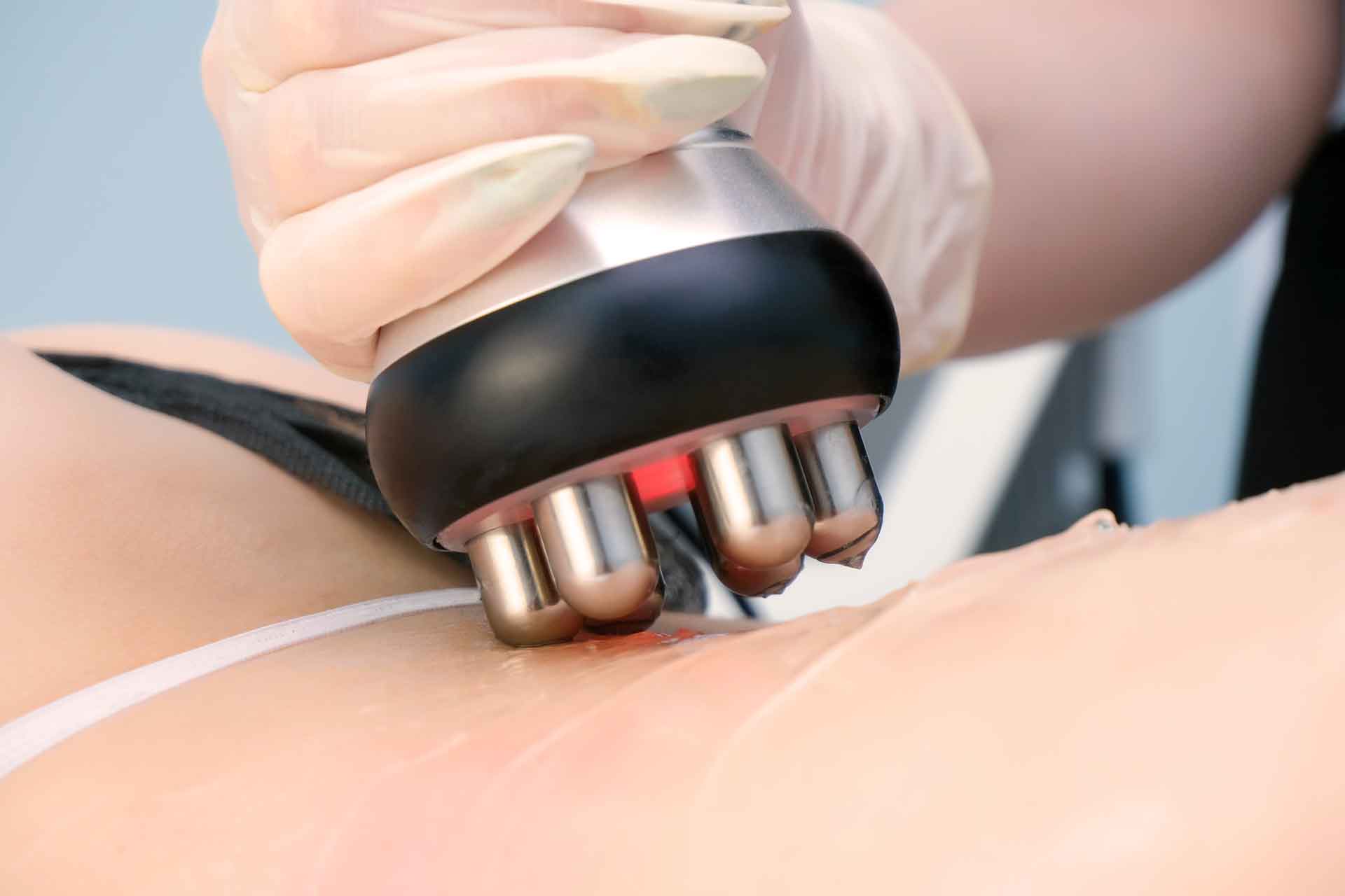 Radiofrecuencia para la recuperación física